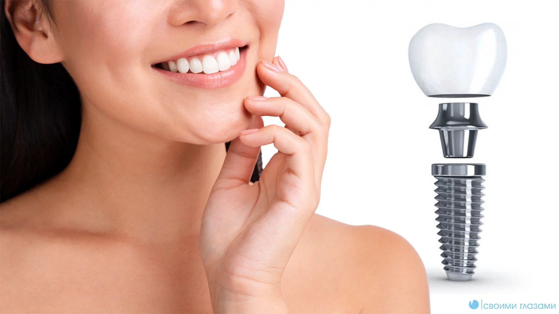 Имплантация зубов