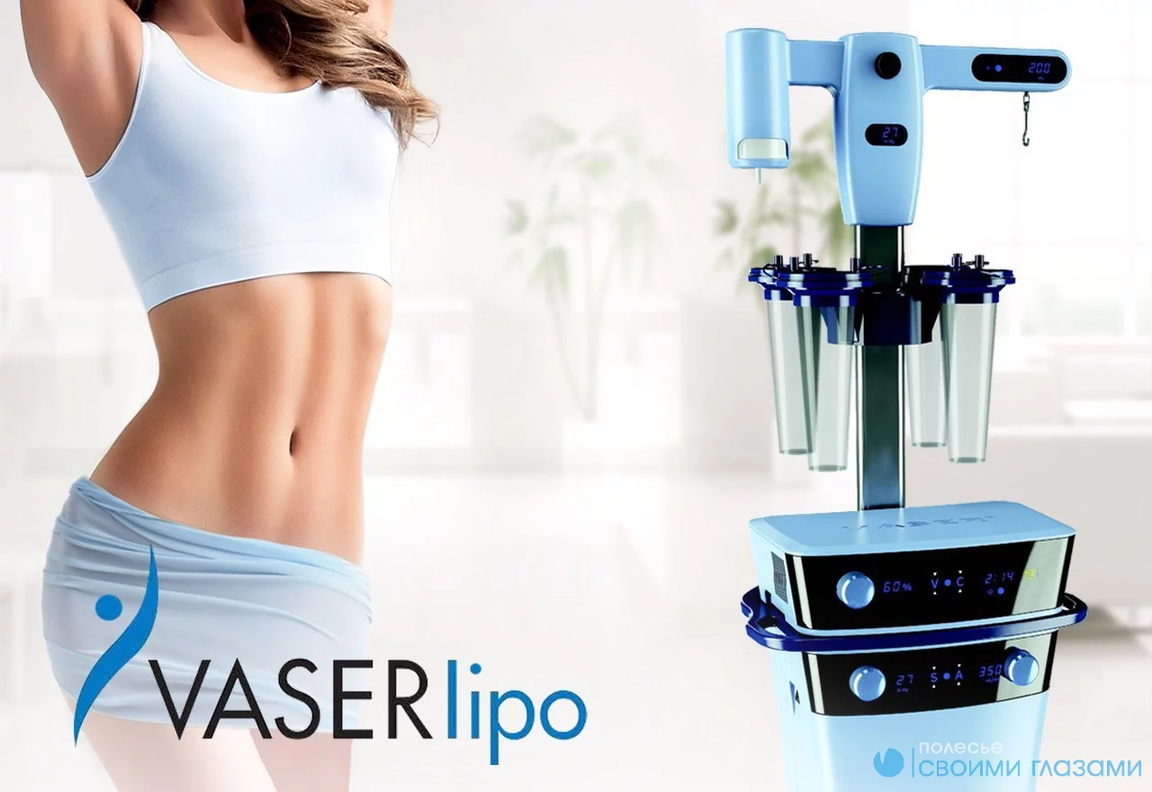 Все о VASER Lipo: анатомия технологии и отличия